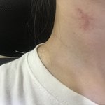 얘들아 이거 키스마크 <b>처럼</b> 보임?