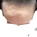<b>니이</b>트판 마빡킹(임판녀, 19세)