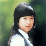서예지 성형 전