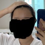 넓은<b>이마</b> 부럽다는 애들은 이런 <b>이마</b> 부럽냐?