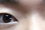 내눈 <b>겉쌍</b>커풀 없애는 수술하면 어떨거같아