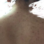 제발 제발 제발 도와주세요ㅠㅠ(등<b>드름</b>,혐오스러울 수 있어요)