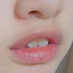 토끼이빨 심각??