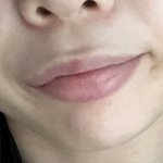 나 <b>팔자</b>주름 겁나 심각한데 어카냐..