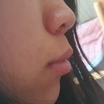 [댓글부탁해] 애들아 <b>돌출</b>입 이런건 어케야하는거냐...