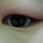 [어떡해야댕] 이거 다래끼인가?