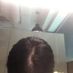 얘들아 나 <b>탈모</b>냐....????...,??