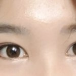 쌍수 <b>내눈</b>어때ㅠㅠ