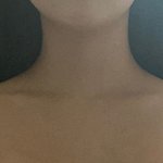 [드루와] 직각어깨 운동 후기