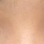 [댓글부탁해] 쌍수 재수술 전 마지막 <b>내눈</b> 보고가 ㅠ