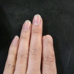 [댓글부탁해] 손가락 잘린 군인 40만원이 끝이래
