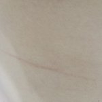 [댓글부탁해] 얘들아 얘들아 얘들아 배에 흉터가 <b>이케</b> 있는데