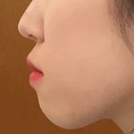 [댓글부탁해] 나 돌출입 많이 <b>심해</b>??