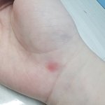 ㅇㄴ 모기<b>새기</b> 여기 어케물었냐;