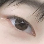 심심해서 올리는 쌍수 후기