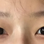 [댓글부탁해] 애들앙 이런코는<b>쉐딩</b>어떻게해야해ㅠㅠ??