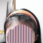 [추반] 초딩때 이 머리띠 쓰고 다녔다vs이.이게뭐<b>노</b> 추반