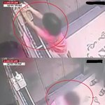 손 <b>소독</b>제 눈에 튀어 5살 여아 각막 손상