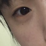 애굣살임 다크<b>서클</b>임??