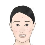 [ㅋㅋ] 허벅지에 손바닥 자국 <b>남음</b>ㅋㅋ