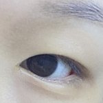 쌍수할까말까 눈이 너무 <b>밋밋</b>해