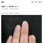 [드루와] 한남 오열...군<b>복무</b>하다 손가락 잘린 군인