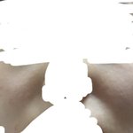 [댓글부탁해] <b>팔자</b>주름 많이심해....???