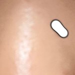 [조언부탁해] 다크<b>서클</b> 어떻게 해야 할까??