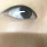 [댓글부탁해] 내눈 쌍수랑 <b>앞트윔</b> 밑<b>트</b><b>윔</b> 하면 예쁠거같애ㅐ?