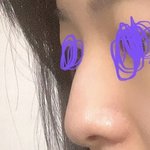 나 코 ㅈㄴ높거든?