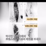 [댓글부탁해] ++)+)트랜스젠더에 대해서 아는만큼 알려줄게