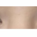 [19] 쌍수 할까 말까 ㅠㅠㅠㅠㅠ ㄹㅇ
