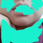 야 나턱 <b>무턱</b>같애??