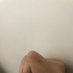 [궁금해요] 여자친구가 꼬집는게 너무 심해요