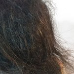 [꼭조언부탁] 어머니 머리카락이 엉켰어요. 이유가 궁금해요. (사진...