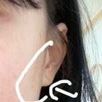[댓글부탁해] 나 광대 대체 왜 이런 거임?