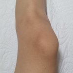 [댓글부탁해] 무릎이 휜건 어떻게 해야하는거야?..