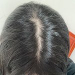 [댓글부탁해] ? 나 탈<b>모야</b>?