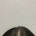 애들아 나 <b>탈모</b>같니..?