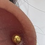 [이것좀봐줘] 이거 피어싱 <b>염증</b> 맞지?