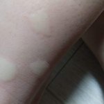 [이것좀봐줘] 모기 죽여버리고 싶다