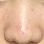 [혐주의] 나....<b>복코</b>야???
