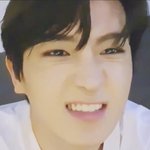 이재현 오빠 <b>윗니</b>보여