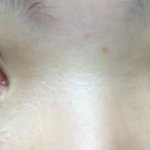 [이것좀봐줘] 쌍수를<b>한지</b> 2년째입니다 그후 또 욕심생겨요
