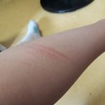 이거 ㅈㅎ<b>자국</b>으로 보여?