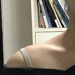 [댓글부탁해] 나 승모근 <b>심해</b>??