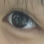 나 눈 <b>통통</b>함