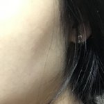 [드루와] 나 교정하고 볼꺼짐 현상생김