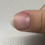 얘들아 <b>손톱</b> 얇은건 어떻게 해ㅜㅠ??