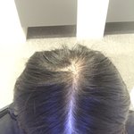 [이것좀봐줘] 나 이거 <b>탈모</b>야...?